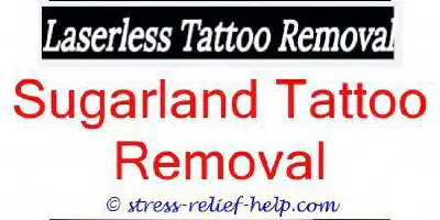 Entfernung von Oberarm-Tattoos