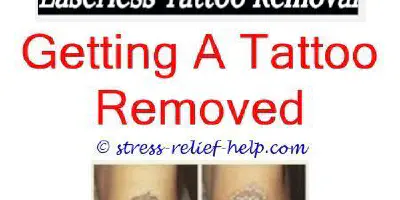 Kann ein schlaffer Tattoo-Flügelarm entfernt werden?